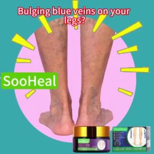 【SooHeal】Varicose Veins Cream Varicose Veins Ointment Eliminate Blue Vein Bulges Quickly Relieve Swelling NET20g