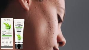 Viareline  Pembersih Wajah Asam Salisilat   Pembersihan wajah lembut kontrol minyak yang menyegarkan pelembapan pori halus dan mencerahkan kulit.