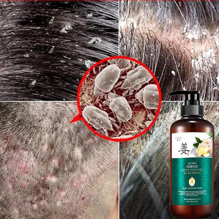 Anti hair fall shampoo anti hair loss shampoo hair shampoo salon herbal ...