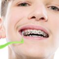 Isi 10 Interdental Brush Sikat Gigi Interdental Behel Sikat Gigi Ortho Behel Braces. 