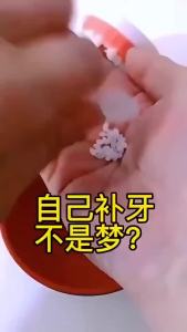 【Ship in 24H】False Teeth Fill Missing Teeth Tooth Filling Solid Denture Material Temporary Tooth Fix Broken Gaps Filling Denture Solid 假牙固体牙胶修复破损缝隙填充