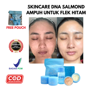 Paket Perawatan Kulit Wajah SR12 Serum Essence - Penghilang Flek & Jerawat dengan Ekstrak Salmon BPOM