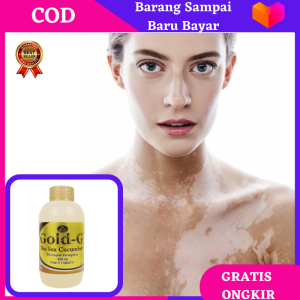 Obat Vitiligo Ampuh/ Protopic Vitiligo Soralen Vitiligo Penghilang Tiange Bercak Putih pada Tubuh / Vitiligo Treatment Obat Vitiligo Paling Ampuh