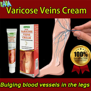 LaSeller Ready Stock 20G Varicose veins Varicose veins cream Varicose veins treatment Varicose veins remover Varicouse veins remover Varicose vein removal cream Vein Pain Effective Healing Cream