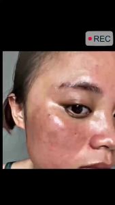 Whitening Cream Anti Freckle Face Cream Remove The Black，Melasma Dark Spot Acne s On The SkinBrighten Skin Care؜