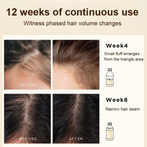 Rosemarycontrolling smooth and fluffy shampoo for dry and frizzy hair