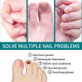 【100% Effective】Jaysuing Fungal Nail Treatment Patch Anti Infection Paronychia Thickening Soft Waterproof 32pcs. 