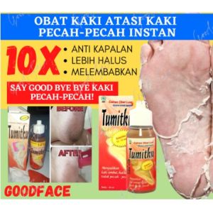 Tumitku 30 ml Bpom Obat Kaki Pecah2 Penghilang Kapalan Kutu Air Lengkap Dengan Kerikan