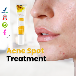 ACNE SPOT TREATMENT 24 Jam: Solusi Jerawat Kempes Dalam Sehari