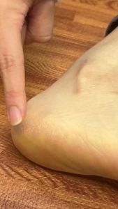Mặt nạ dưỡng da tay và chân chuyên sâu Epielle giúp phục hồi và cung cấp độ ẩm cho da khô nứt nẻ bộ quà tặng chăm sóc bản thân dành cho phụ nữ bộ sản phẩm spa bao gồm 6 đôi găng tay dưỡng ẩm và 6 đôi tất dưỡng ẩm.