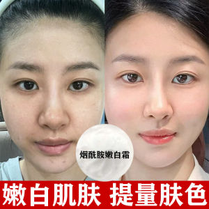 酰胺面霜强效去雀斑黄褐斑炸斑霜酰胺美嫩白祛化斑霜去黑色素