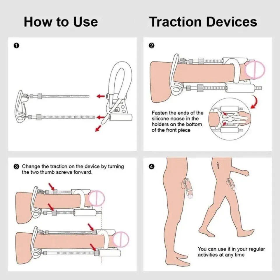 GEKANGELL Enlargement Stretch Clamp Extender Stretching