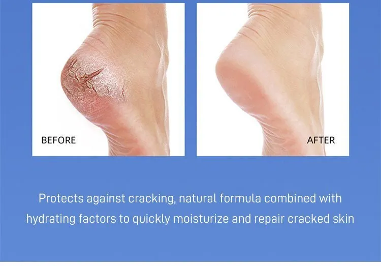 Vaseline Foot Blam Petroleum Jelly Moisturizing Stick Anti