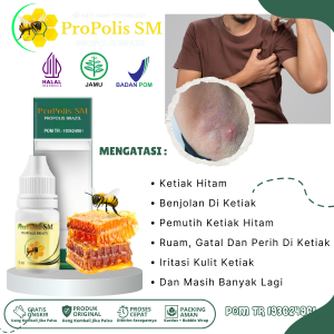 Obat Ketiak Hitam Pemutih Keriak Hitam Benjolan Di Ketiak Bisul Di Ketiak Ruam Merah Gatal Dan Perih Di Ketiak Iritasi Kulit Ketiak Dengan ProPolis SM