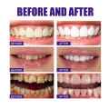 สไตล์ออสเตรเลียสุดฮอต Mugwort ANCE CLAY STICK V34 ยาสีฟันฟันขาว กำจัดกลิ่นปาก ฟอกฟันขาว ลดคราบหินปูน ลดกลิ่นปาก คราบฟัน （ยาสีฟันลดกลิ่น น้ำยาขัดฟันขาว เจลฟอกฟันขาว ）. 
