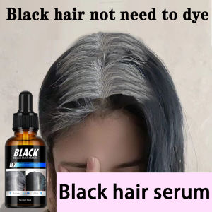 Black Hair Concentrated Serum Natural Black Hair Serum Gray hair in old age genetic gray hair stress gray hair Hair root turn black prevent hair loss