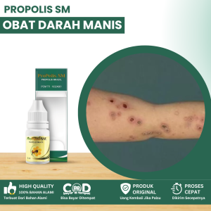 Obat Darah Manis Obat Kulit Amis Daging Obat Penghilang Gatal Pada Kulit Obat Bekas Luka Koreng Menghitam Obat Penghilang Bekas Luka Penghilang Garukan Obat Kulit Korengan Bintik Bintik Di Kulit Luka Bernanah Dengan Propolis SM