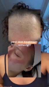 DA EFFECT Cooling ment Mask Soothing Face Mask for After Sun Care Stressed Sensitive Skin Post-ment Barrier Care Calming & Hydrating Gel Sheet Mask 25g x 5 Sheets