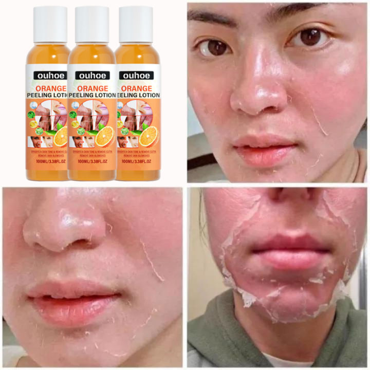 OUHOE Yellow Peeling Oil Orange Peel Body Lotion Body Peeling Oil