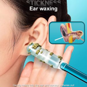 Sticky Ear Cleaning Tool Cleaning Ear Cleaning Spoon Sticky Earwax Stick Cotton Swab Luminous Ear Cleaning Adult Ear Cleaning可沾式掏耳勺