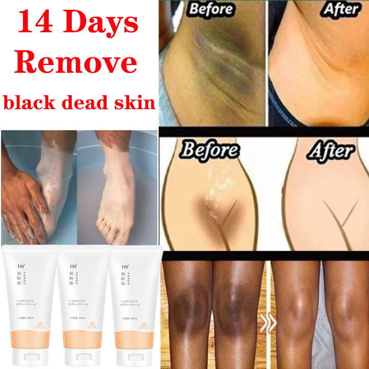 Dead skin online removal body