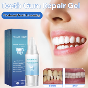 Teeth Gum Repair Gel Relieve Bleeding Gums Gum Recession Inflammation Treatment Tooth Loosening Oral Care Gel
