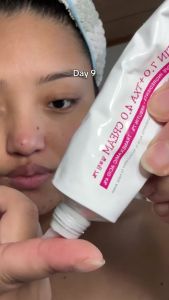 offical promotion TOSOWOONG Arbutin 7% + TXA 4% Cream 50ml Brightening Fade Dark Spots & Pigmentation