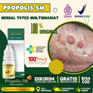 Obat Perontok Kutil Kelamin HPV Perontok Kutil Kelamin Pria dan Wanita Bintik Benjolan Miss v dan Kutil Anus Penghilang Kutil Alami dengan ProPolis SM