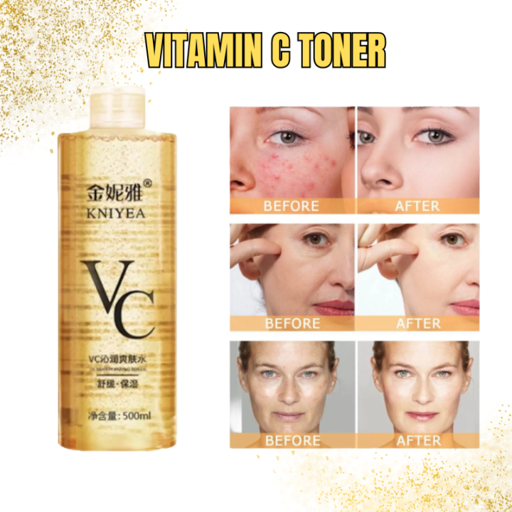 KNIYEA VC TONER I VITAMIN C TONER I SKIN REFINING HYDRATING BRIGHTENING MOISTURIZING FAIAL MIST SKIN CARE TONER 500 ML Even Skin Tone Toner - Lazada | Lazada PH