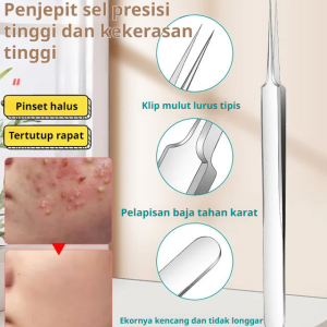 Get Clear and Healthy Skin with Iziliens Blackhead Extractor and Pimple Popper.