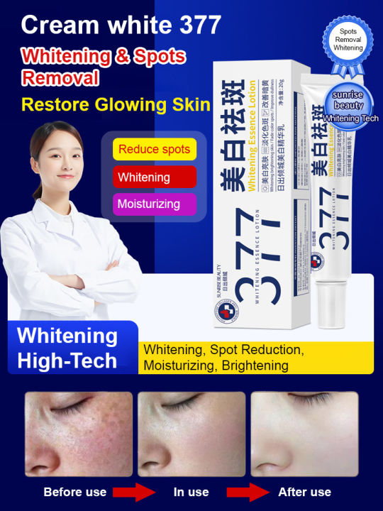 377 Whitening Spots Removal Cream Improve Skin Pigmentation Serum ...