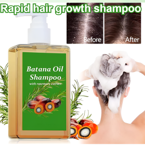 Rosemary shampoo Hair nourishing and strengthening shampoo Hair growth shampoo Anti-hair loss shampoo