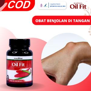 Obat Benjolan Di Tangan Obat Kista Ganglion Obat Benjolan Siku Tangan Obat Penghancur Benjolan Di Tangan Obat Benjolan Di Pergelangan Tangan Obat Benjolan Lemak Di Tangan Obat Benjolan Di Telapak Tangan Dengan Oil Fit