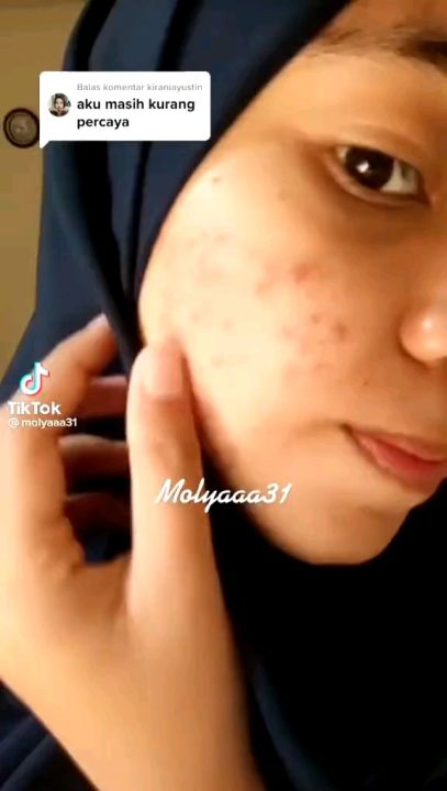 VITALINE SOFTGELS~PEMUTIH BADAN ALAMI~ISI 30 KAPSUL
