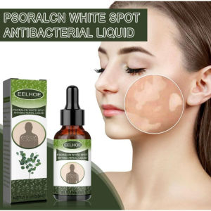 Serum loại Bỏ Lang Ben Bạch Biến Hắc Lào Da Vẩy Trắng Không Đều Màu EELHOE 30ML