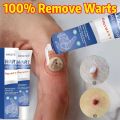 warts remover cream original painless 20g Warts Magic Remover Wartz Removal Cream Warts Remover Skin Kulugo Remover Skin Growth Warts Remover Mole And Warts Remover warts remover cream ointment warts remover original. 