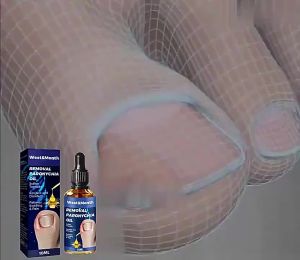 anti paronychia relief oil ingrown toenail nail fungus treatment toe nail ingrown corrector paronychia pain relief 甲沟炎嵌甲