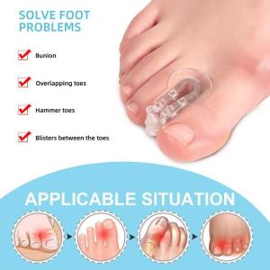 2PCS Big Toe Straightener Thumb Valgus Protector Soft Silicone Foot Fingers Toe Separator Bunion Adjuster Feet Pads Relief Foot Pain