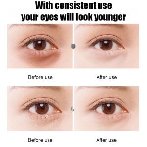 Snail Essence Eye Mask Anti-Wrinkle Hydrating Patch Moisturizing Eye Care