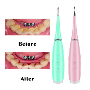 เครื่องขัดฟันอัลตราโซนิคไฟฟ้าเครื่องกําจัดคราบฟันเครื่องมือทันตแพทย์รักษาสุขภาพฟันให้ฟันขาว