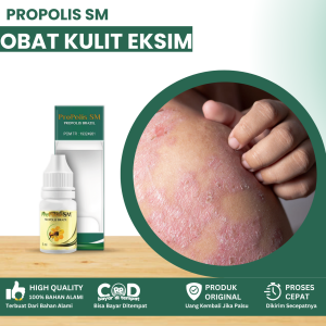 Obat Kulit Eksim Obat Eksim Kering Menahun Obat Eksim Basah Eksim Kering Obat Gatal Eksim Obat Kulit Gatal Obat Kulit Bersisik Obat Eksim Parah Obat Kulit Bersisik Dan Gatal Dengan Propolis SM