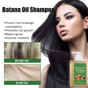 Batana Oil Hair Growth Shampoo Anti-Hair Fall Hair Shampoo Cleansing Anti Dandruff Moisturize Hair Roots Scalp Repair Serum