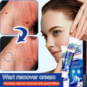 【Wart Removal Cream】祛尤膏 Painless Wart Removal Without Scarring/Skin Warts/Flat Wart  Cream