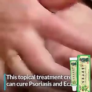 MY 热卖 现货Natural anti itch cream suitable for allergies eczema psoriasis mosquito bites athletes foot blisters skin peeling fungal infections etc. Quick sterilization itching relief and repair.