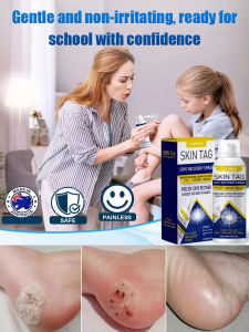 LANISKA Wart Care Topical Spray External Wart Remover Fast Acting Formula Gentle Cleansing Adults Skin Treatment