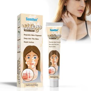 7 ngày bay sạch đốm trắng trên da Sumifun làm đều màu da loại bỏ bạch biến lang ben cải thiện màu da không đồng đều với công thức ưu việt loại bỏ các đốm trắng không đồng đều trên da