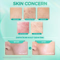 Hanasui Ceramide Probiotics Peeling Gel - Eksfoliasi Gel Wajah Perbaiki Skin Barrier Mencerahkan dan Angkat Sel Kulit Mati Komedo. 