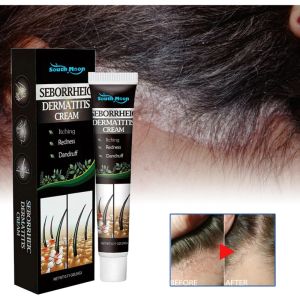 Anti Dandruff for Scalp Itching and Dandruff for Men & Womenanti Hair Loss anti ketombe cream