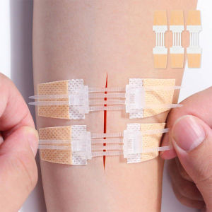 hananre Zipper Band-aid Painless Wound Closure Patch Suture-free Wound Dressing Patches Zip Suture Reducer Band Aid Outdoor Portable