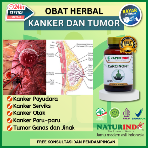 Obat Kanker Payudara Ampuh Benjolan FAM Mastitis Tumor Jinak Ganas Herbal Alami